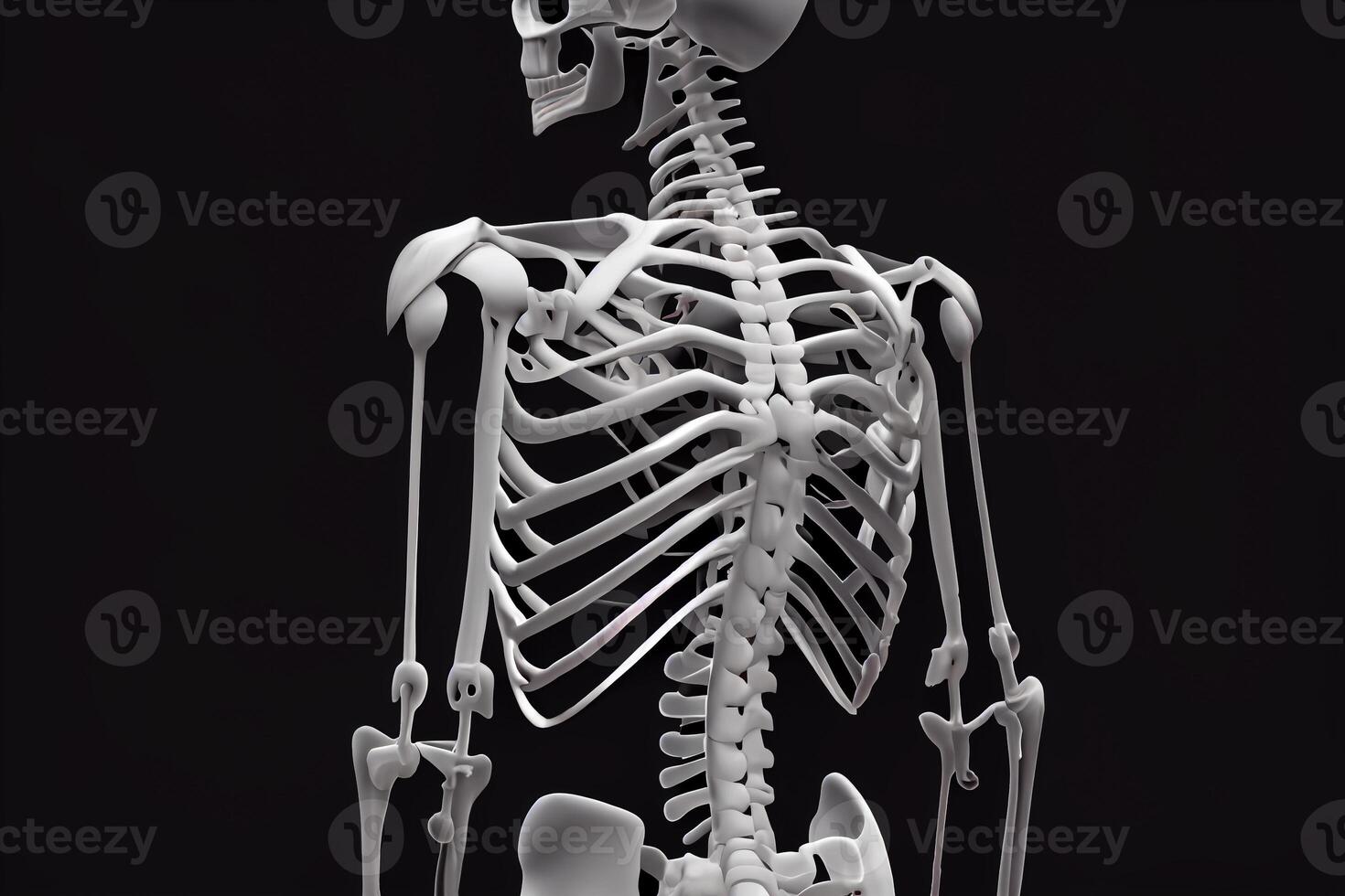 gebogen wervelkolom scoliose, menselijk skelet met scoliose, illustratie generatief ai foto