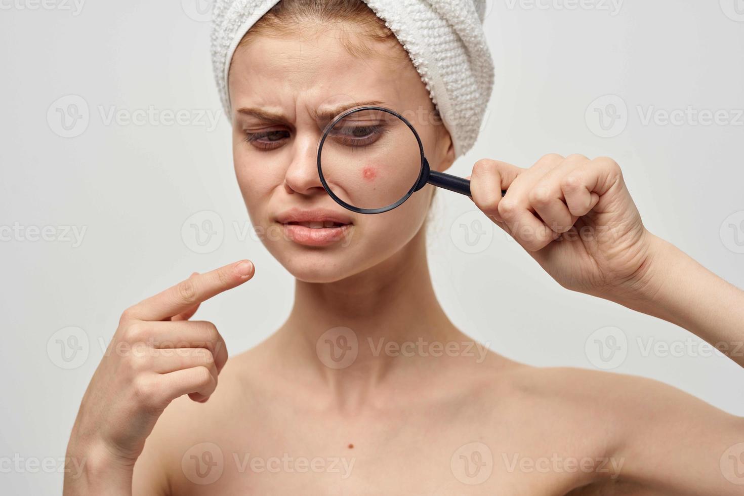 mooi vrouw met een handdoek Aan mijn hoofd huid problemen detailopname foto