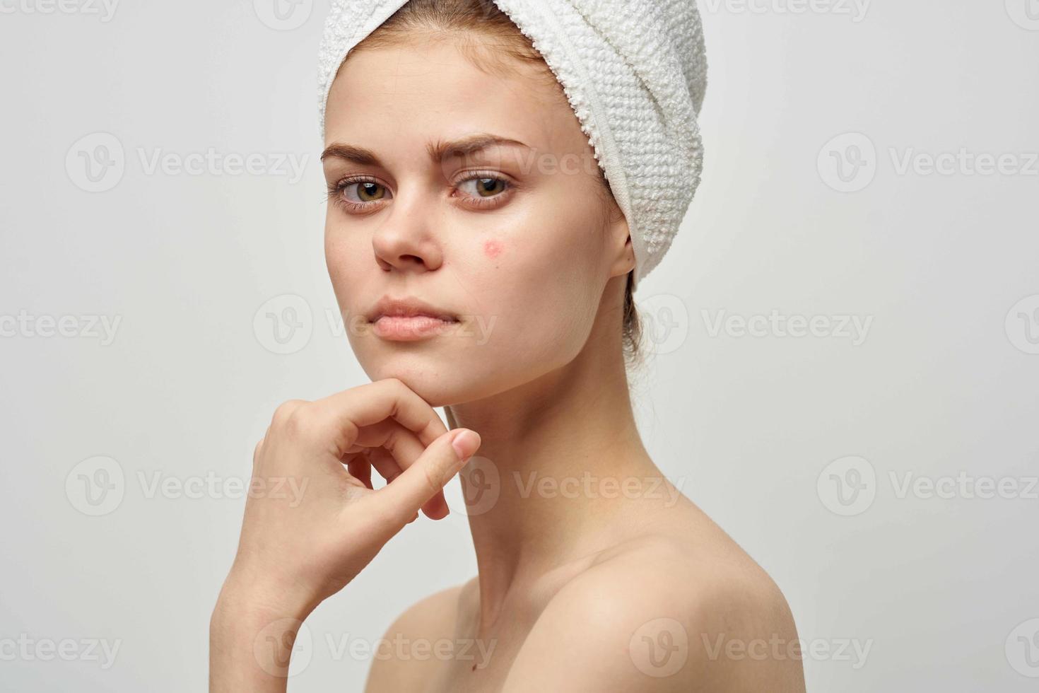 mooi vrouw met een puistje Aan de gezicht dermatologie geïsoleerd achtergrond foto