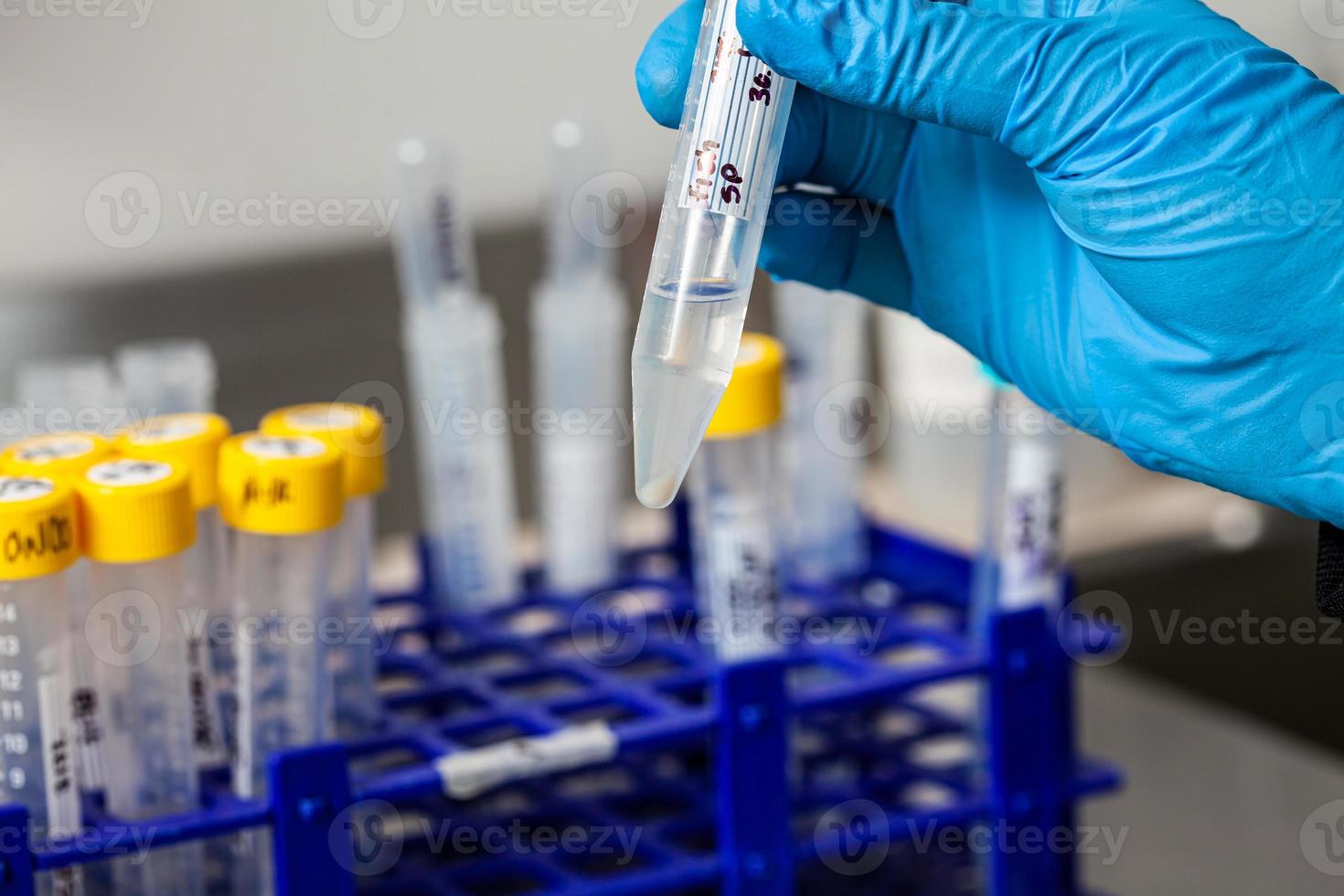 test buis met bloed cellen pellet verkregen na meerdere wast en centrifugeren. foto