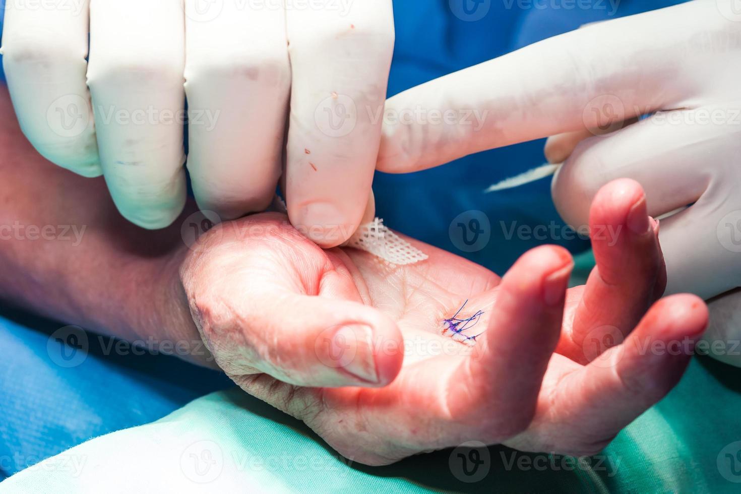 chirurg verband de hand- van een geduldig Bij de einde van chirurgie foto