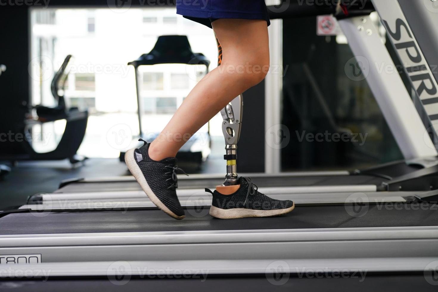 jong vrouw met een prothetisch been met oefening door wandelen Aan een loopband naar praktijk wandelen met de andere prothetisch been naar worden meer flexibel. foto