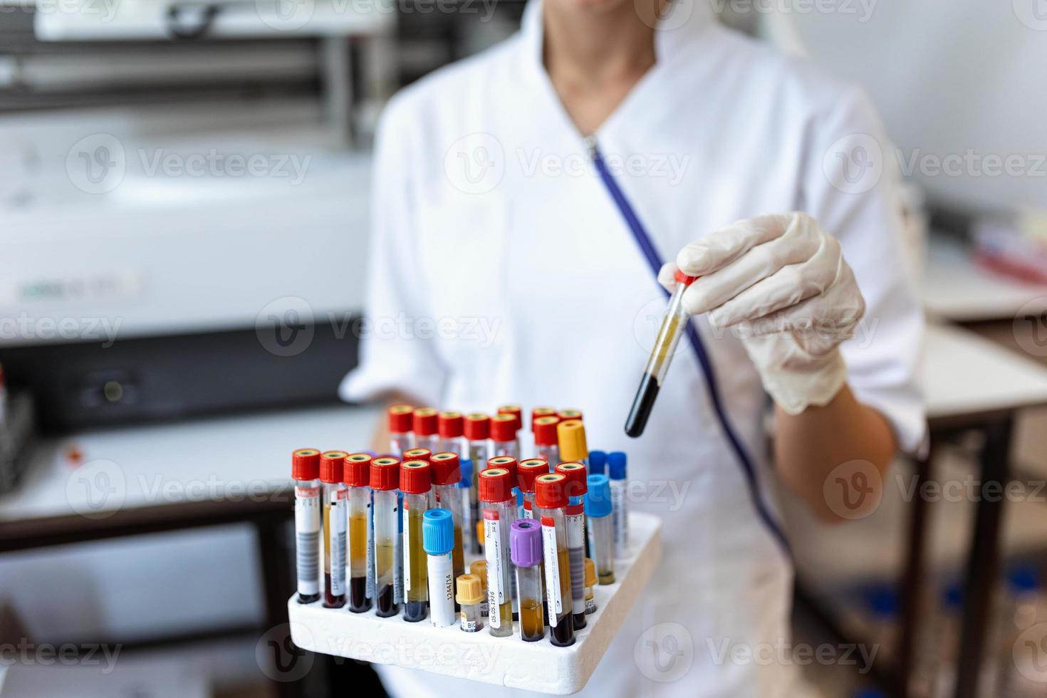 dokter hand- nemen een bloed monster buis van een rek met machines van analyse in de laboratorium achtergrond technicus Holding bloed buis test in de Onderzoek laboratorium foto