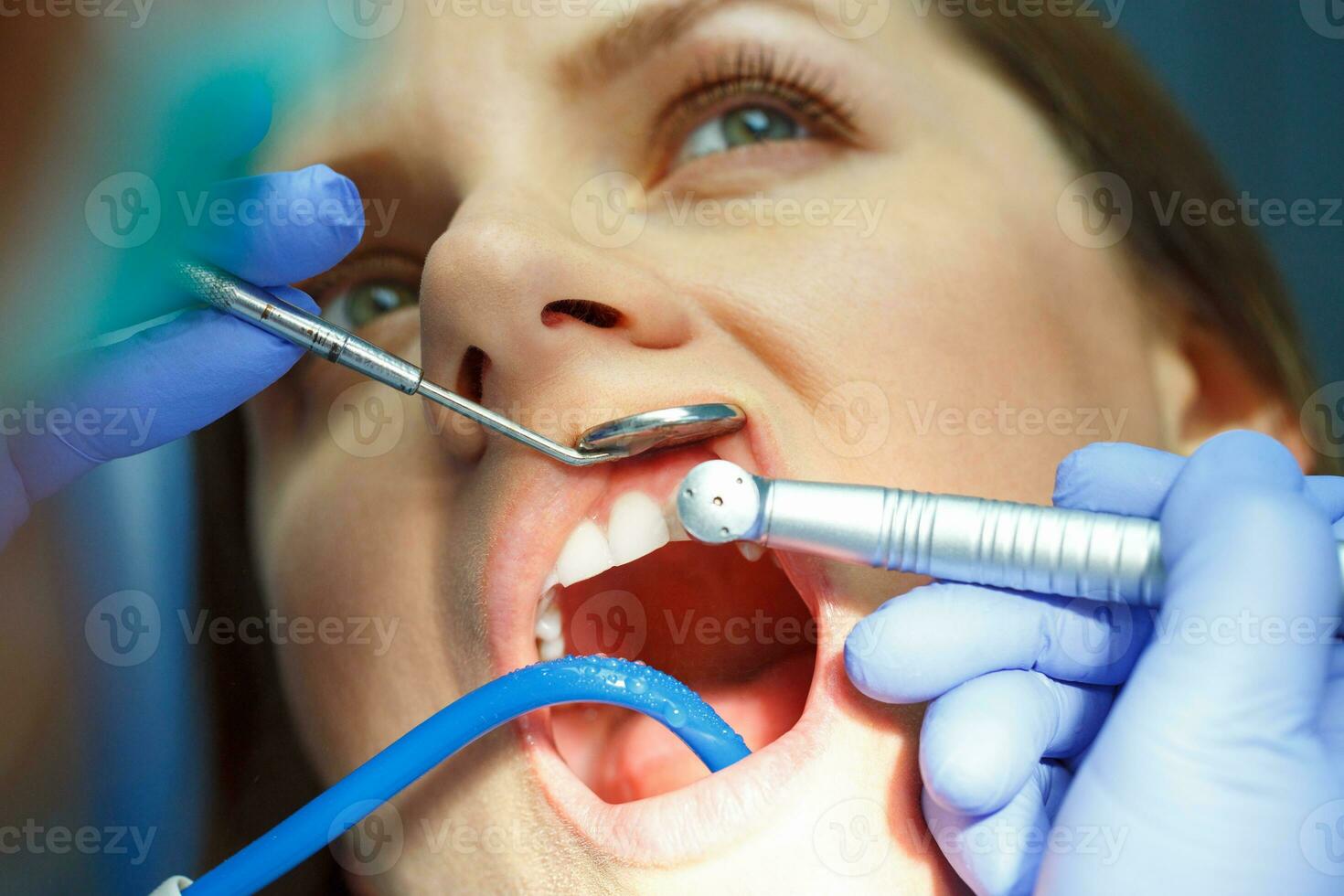 vrouw krijgen een tandheelkundig behandeling foto