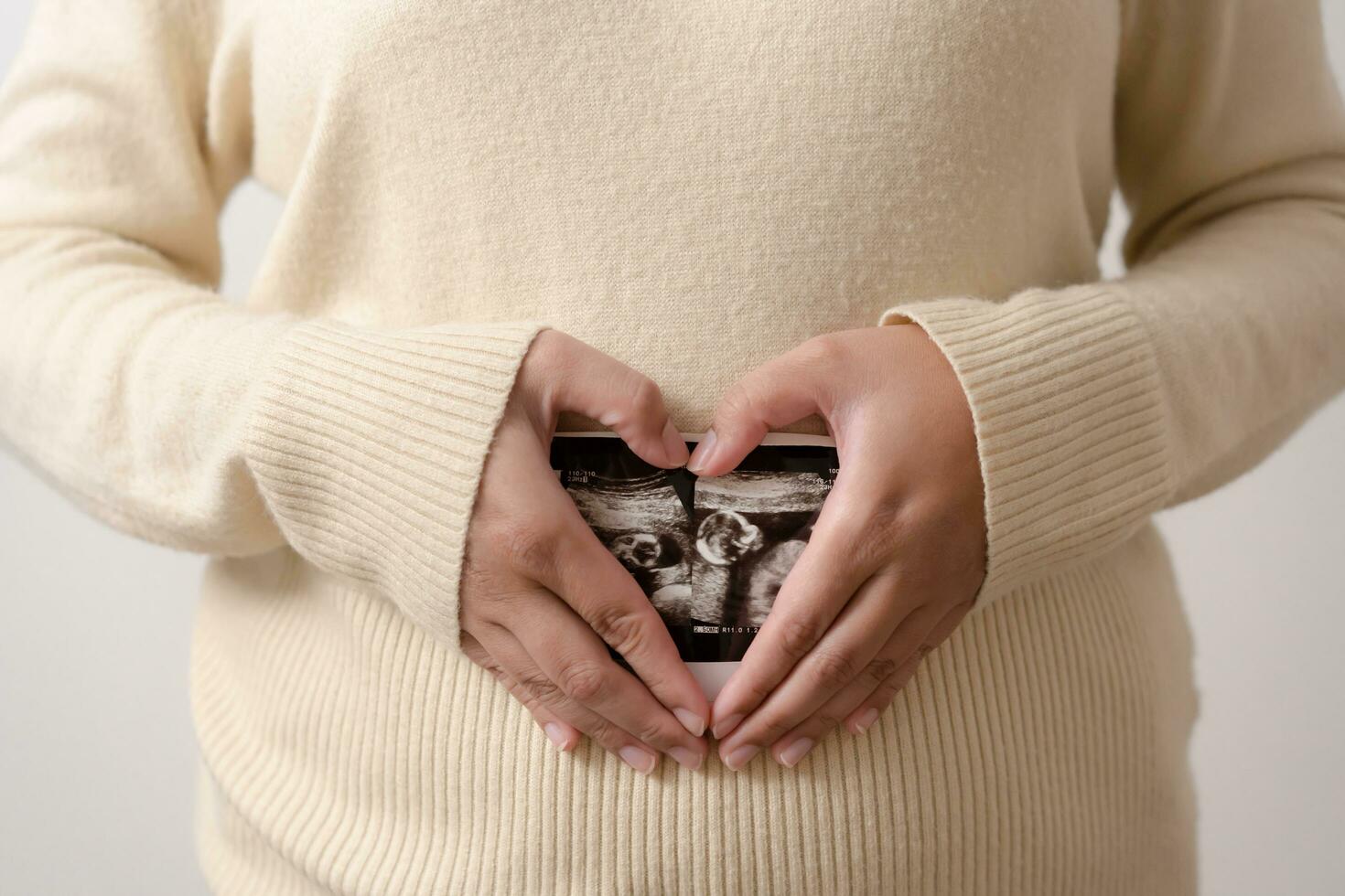 zwanger vrouw Holding echografie film van haar baby. gelukkig moeder en pasgeboren baby in werkwijze. liefde van ouders naar zuigeling in weinig maanden voordat geven geboorte. foto