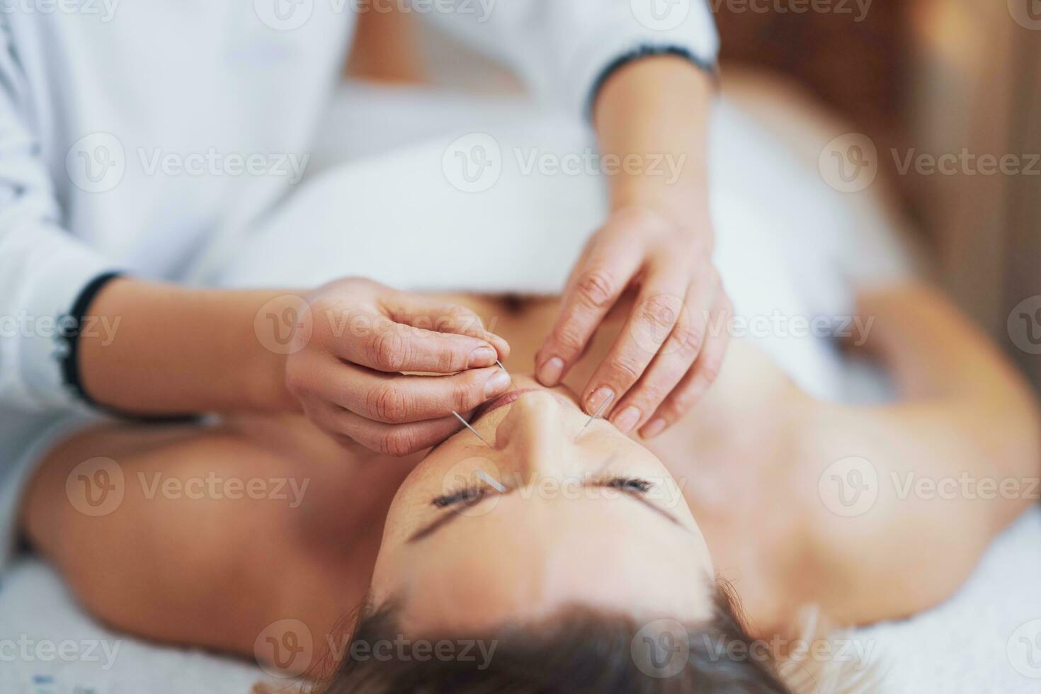 een acupunctuur naald- behandeling in de studio foto