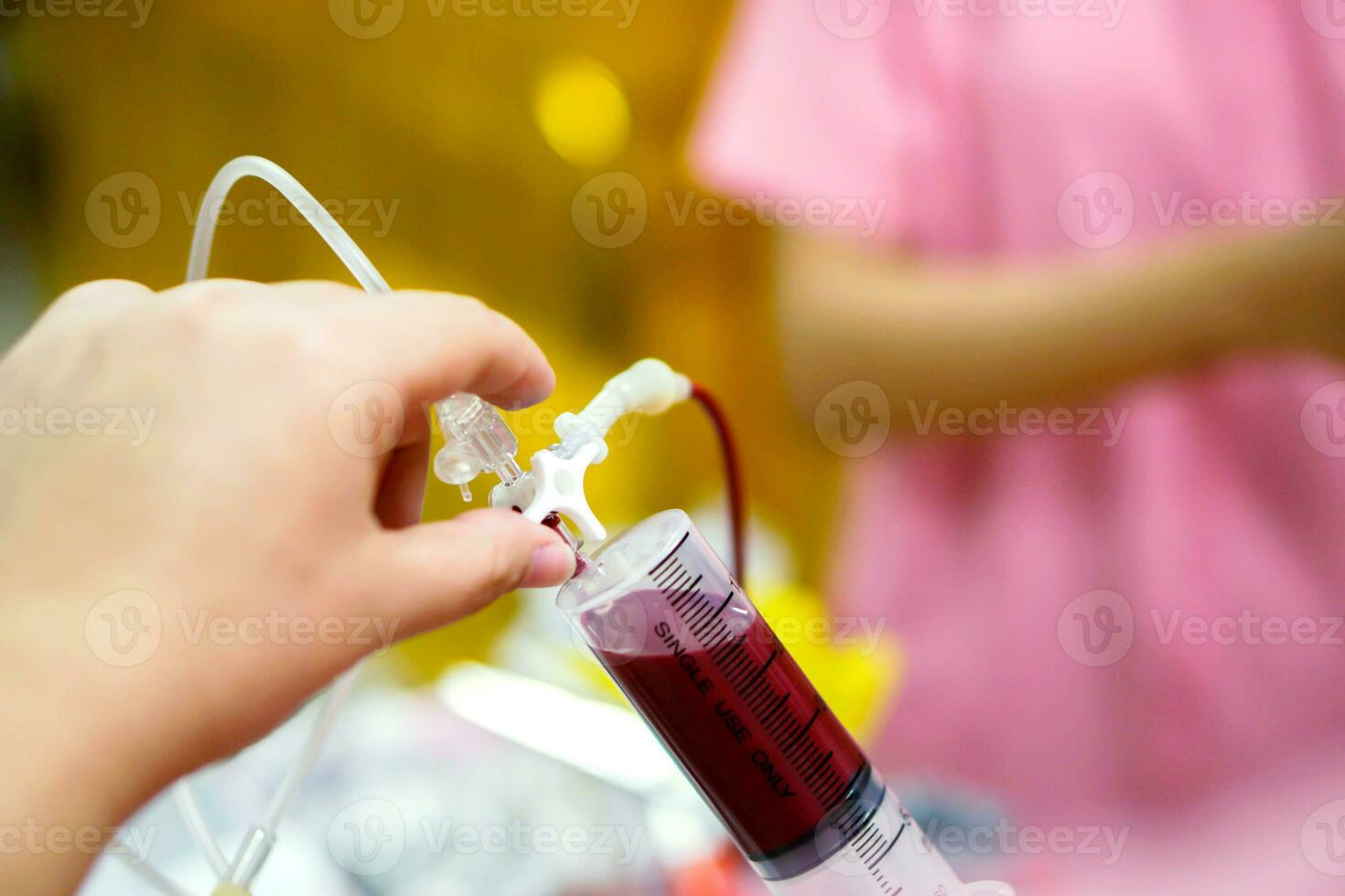 verpleegster handen is aanpassen de injectiespuit naar trek bloed van de bloed zak voor bloed transfusie naar ziek pasgeboren baby in een ziekenhuis. foto