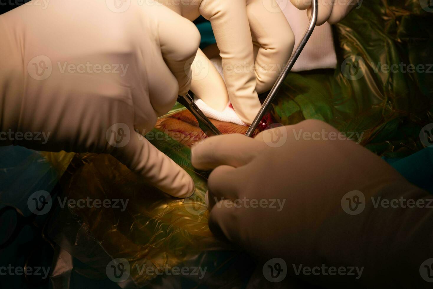 dokter hand- het uitvoeren van insnijding gedurende chirurgie foto
