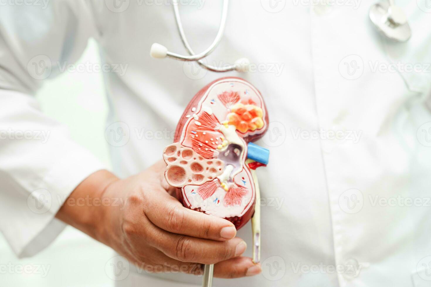 chronisch nier ziekte, dokter Holding model- voor behandeling urine- systeem, urologie, geschatte glomerulair filtratie tarief egr. foto