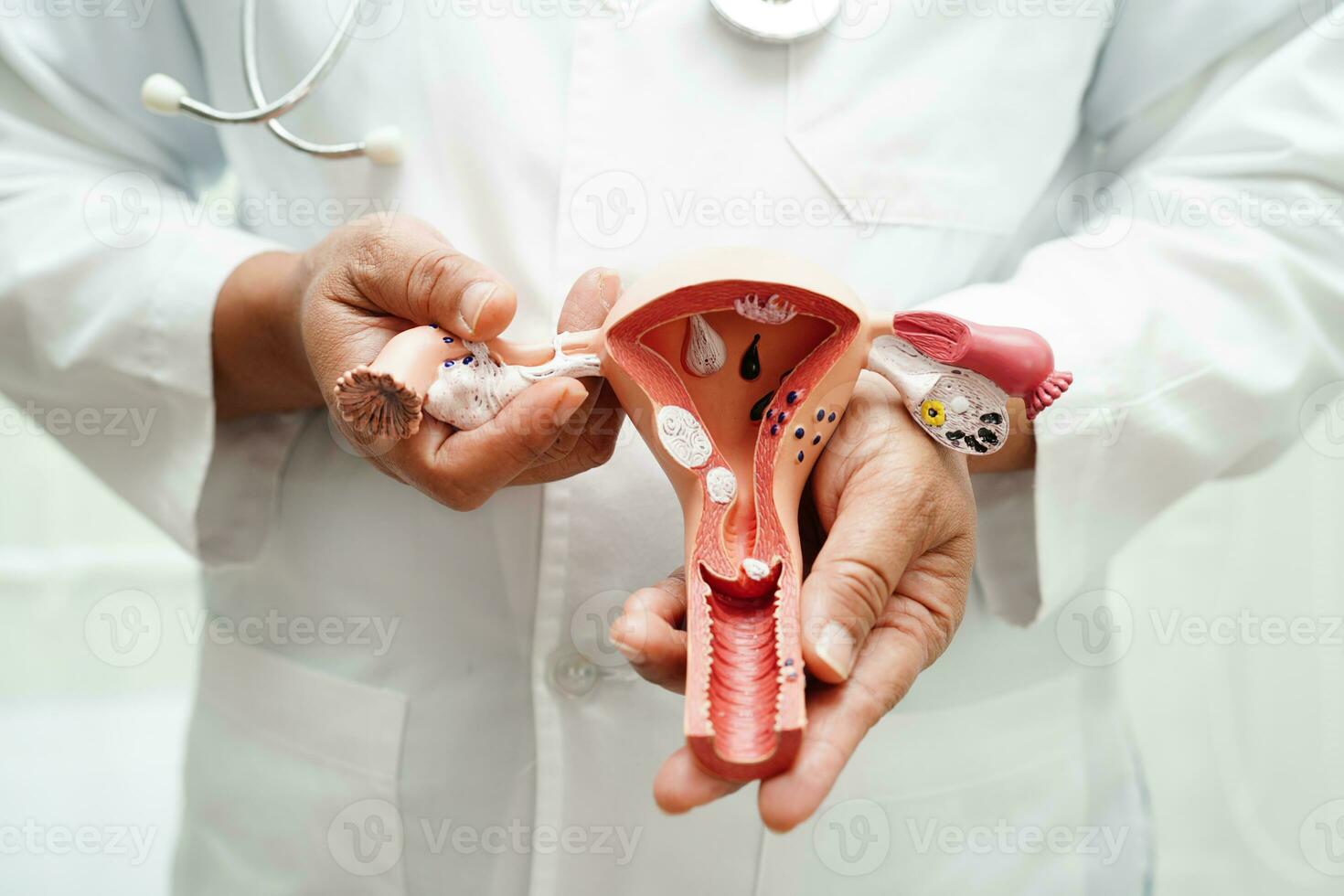 maag ziekte, dokter Holding anatomie model- voor studie diagnose en behandeling in ziekenhuis. foto