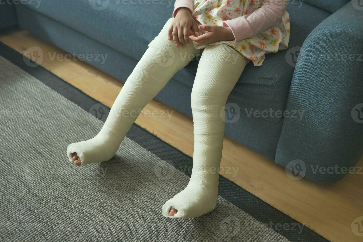weinig kind met gips verband Aan been. foto