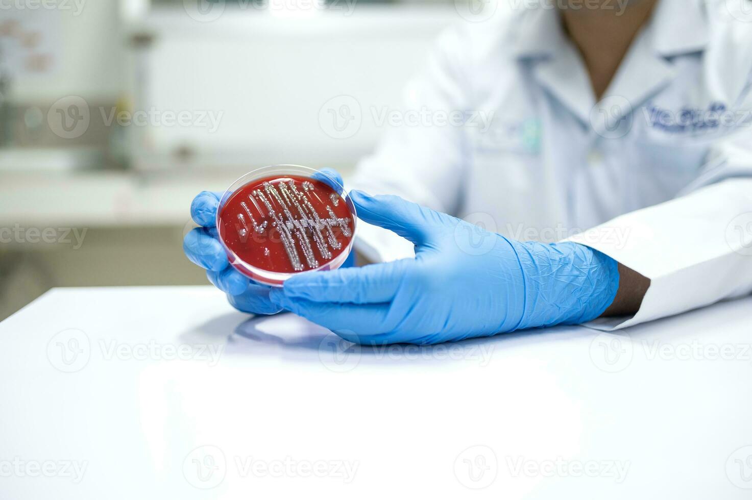 dokter Holding wit bacterie Aan bloed agar in ziekenhuis microbiologie afdeling bacterie identificatie foto