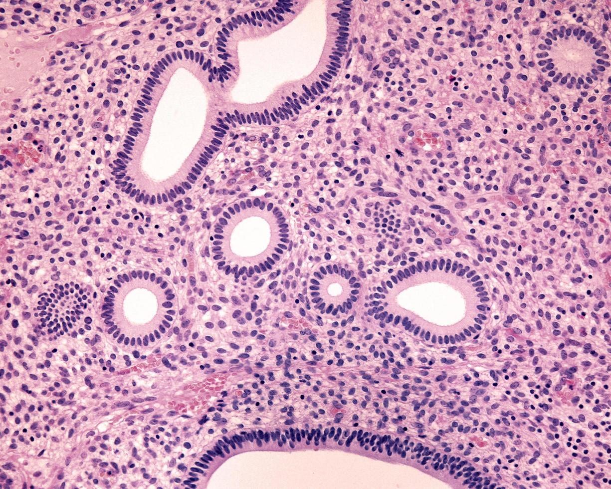 proliferatieve fase van het endometrium foto