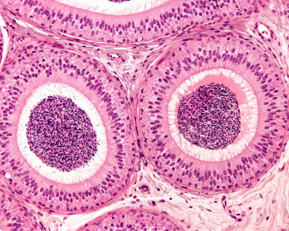 pseudostratified epithelium epididymis foto