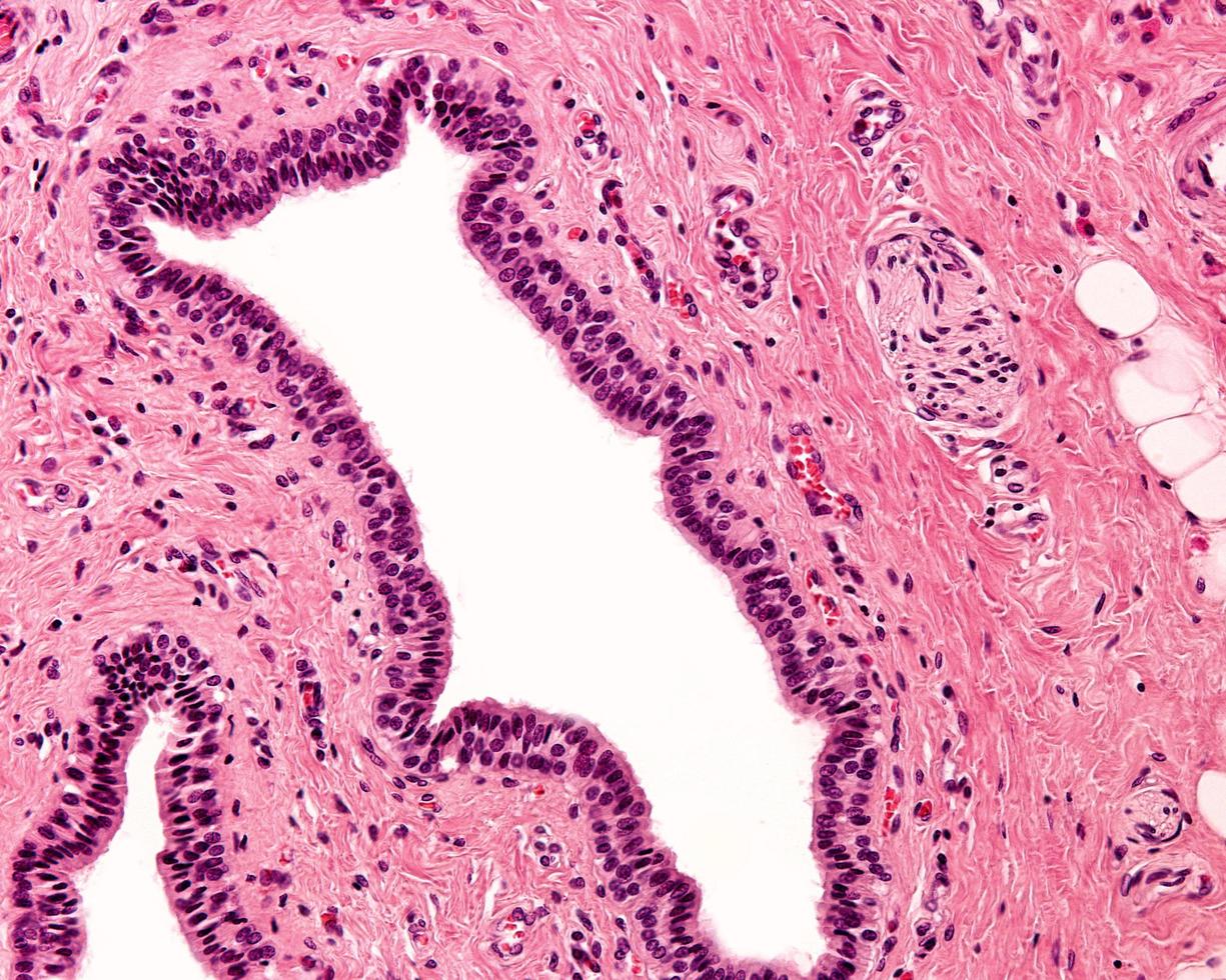 gestratificeerd kolomepitheel foto