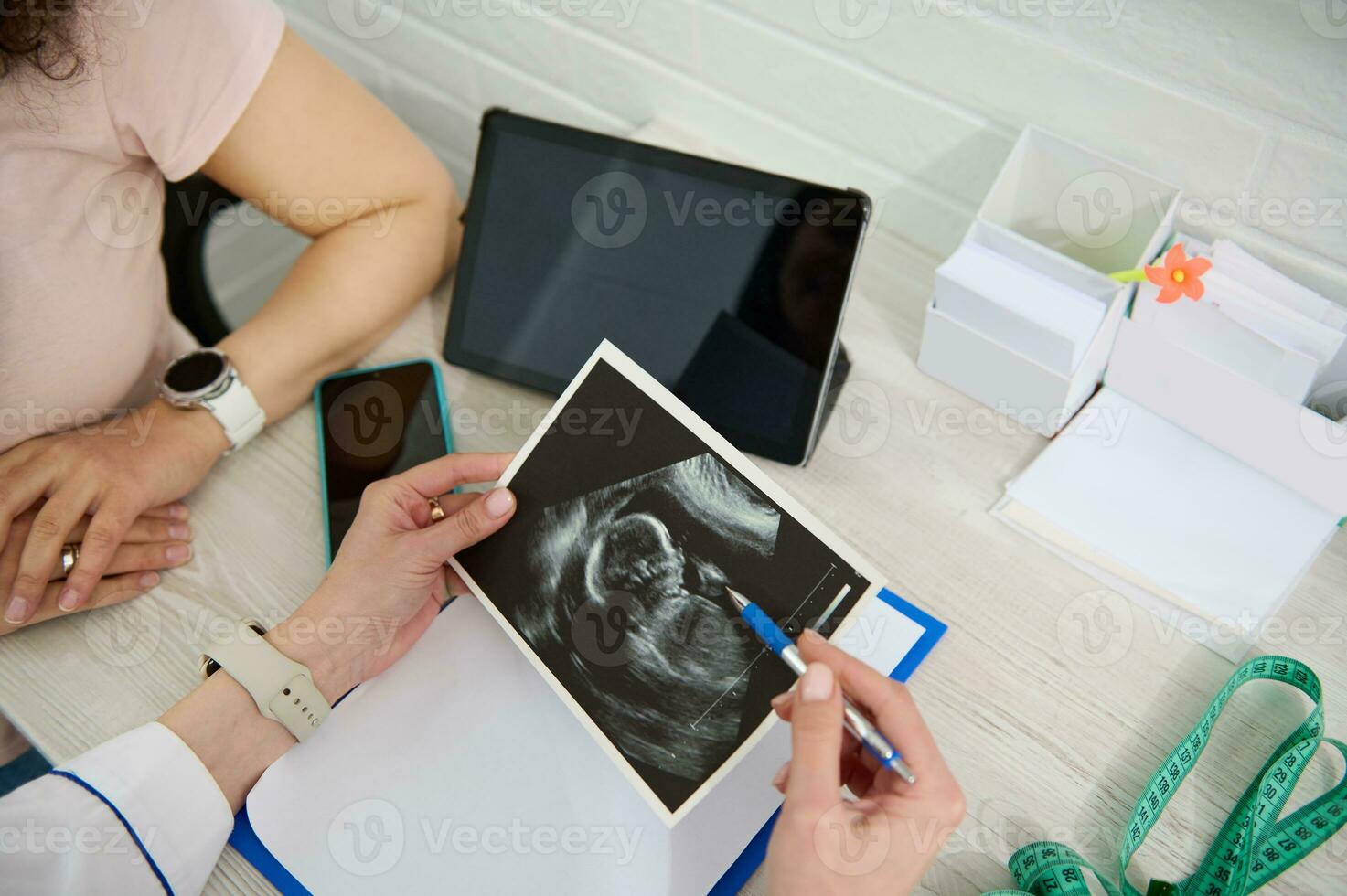 top visie handen van gynaecoloog dokter uitleggen naar zwanger vrouw de ontwikkeling van kind in baarmoeder Aan echografie scannen foto