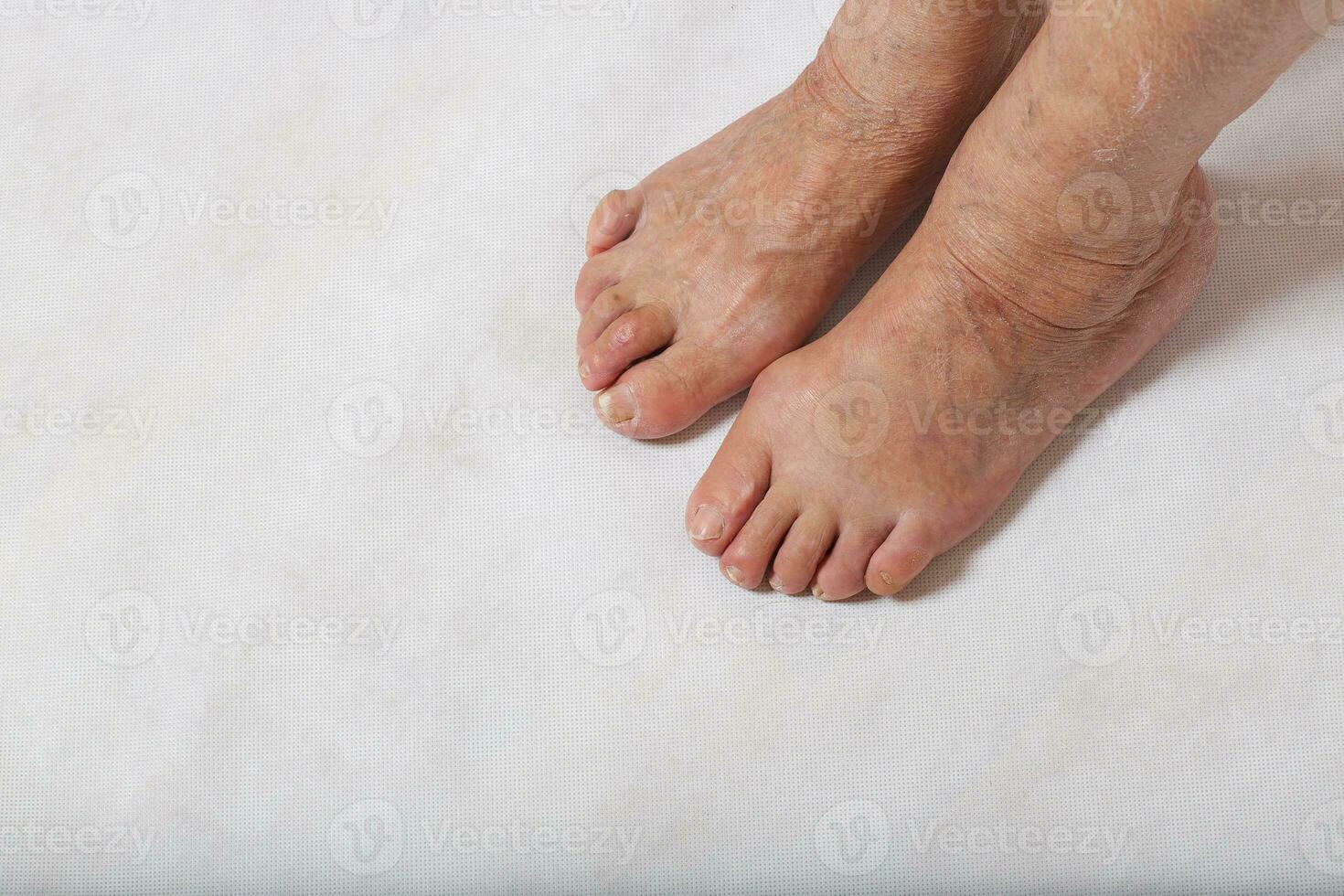 voeten van een senior vrouw. detailopname foto