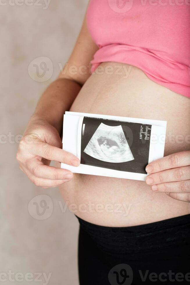 jong zwanger vrouw houdt usg beeld van haar baby. foto