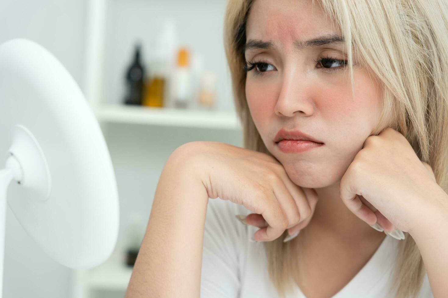 jong vrouw Aziatisch zijn bezorgd over gezichten dermatologie en allergisch naar steroïden in cosmetica. gevoelig huid, rood gezicht van zonnebrand, acne, allergisch naar Chemicaliën, uitslag Aan gezicht. huid problemen foto