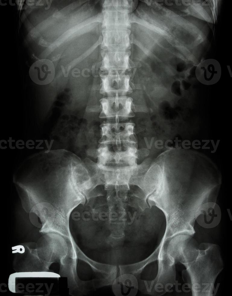 x-ray lumbosacrale wervelkolom en bekken van Aziatische volwassen mensen foto