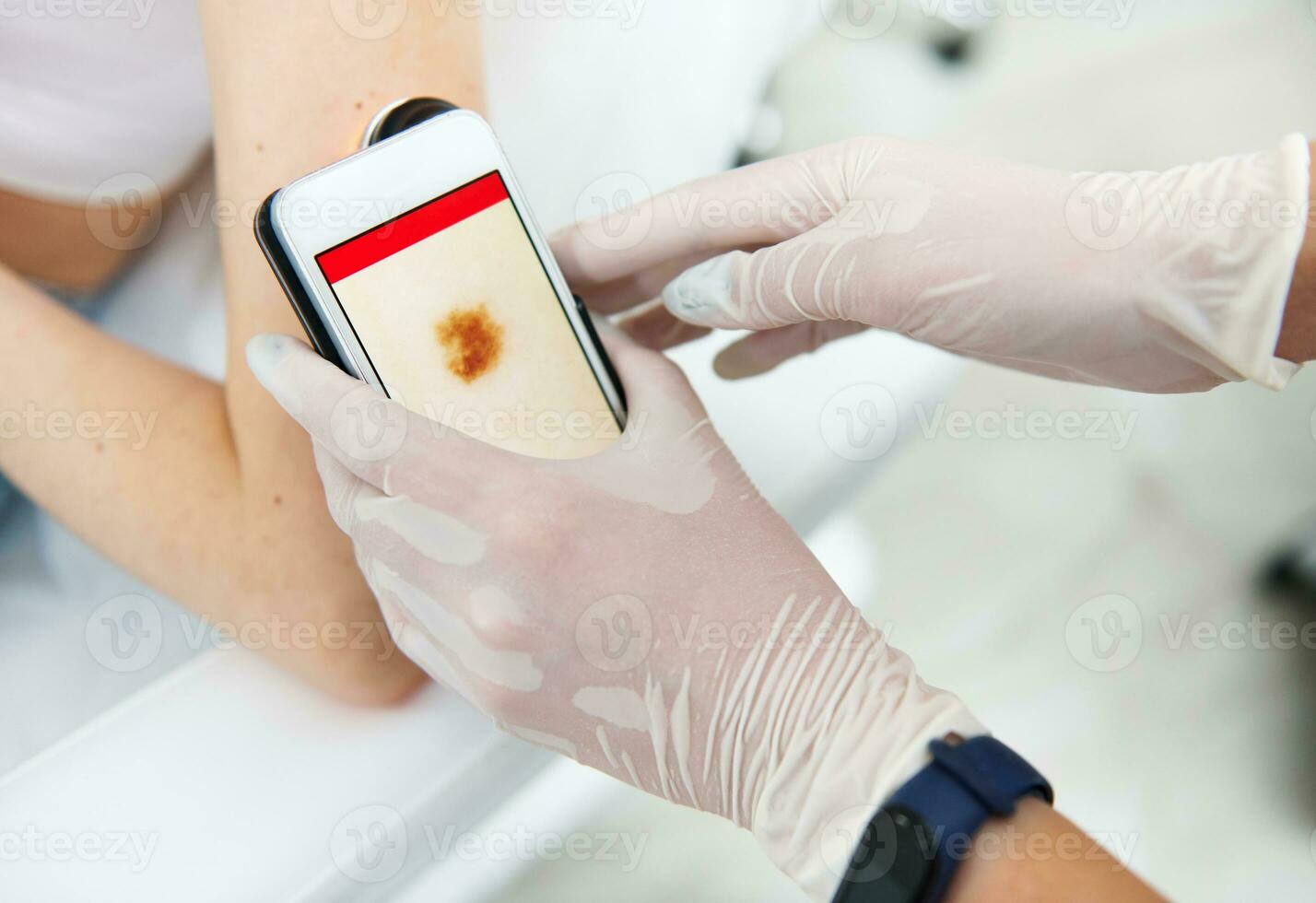 detailopname van een dokter hand- Holding een dermatoscoop en onderzoeken mollen Aan de patiënten arm. kanker vroeg diagnose en het voorkomen concept. dermatoscopie, het voorkomen van melanoma, huid kanker. foto