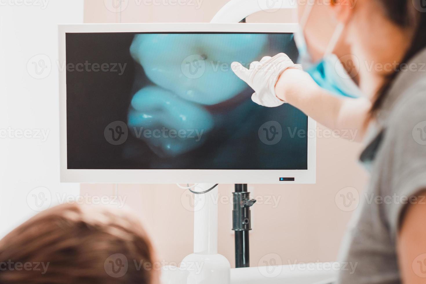 een jonge vrouwelijke tandarts onderzoekt de tanden van een jongen die in een tandartsstoel zit met een tandheelkundige camera. foto