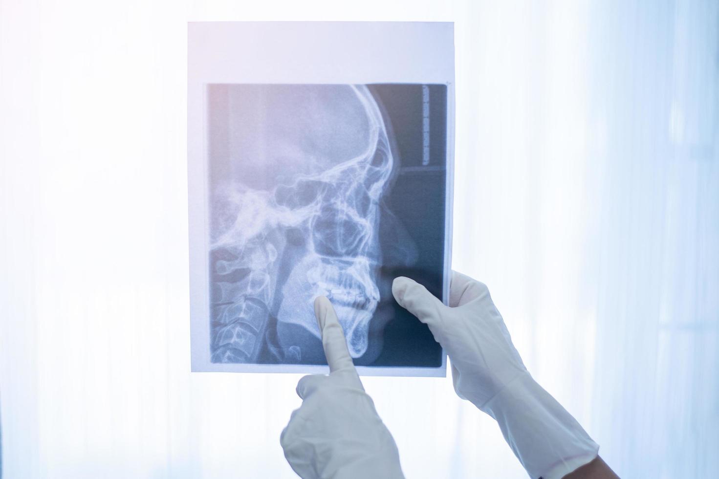 vrouwelijke tandarts met een tandheelkundige röntgenfoto foto
