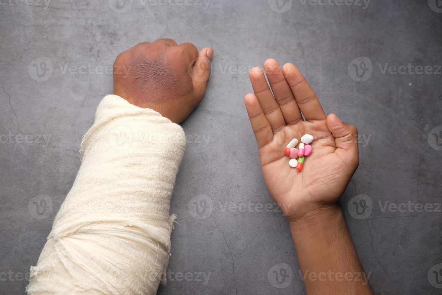 gewonde pijnlijke hand met verband en medische pillen bij de hand? foto