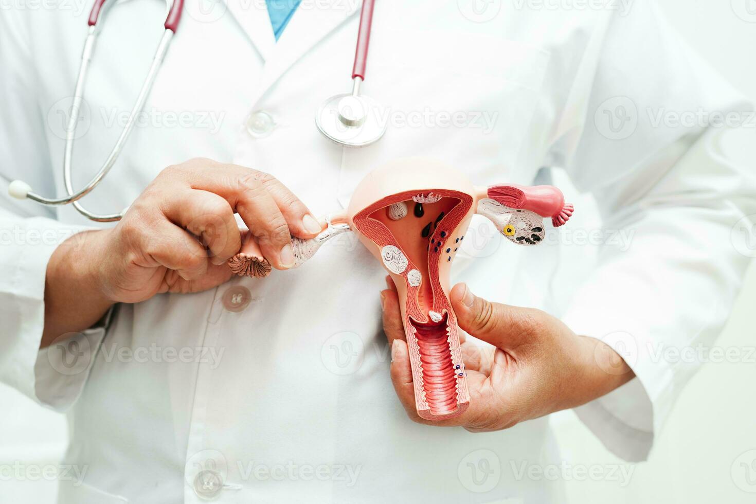 baarmoeder, dokter Holding anatomie model- voor studie diagnose en behandeling in ziekenhuis. foto
