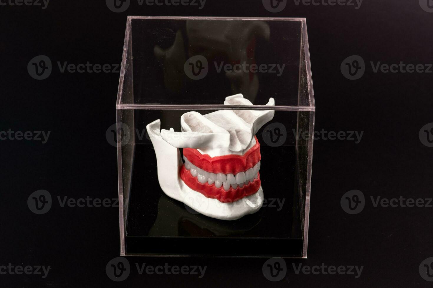 menselijk kaak met tanden implantaten anatomie model- geïsoleerd Aan zwart achtergrond in een glas doos. foto