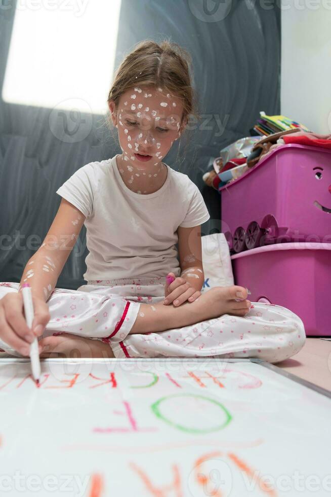 weinig school- meisje met waterpokken tekening Aan wit bord in kinderen' kamer, antiseptisch room toegepast naar gezicht en lichaam. schoolbord en speelgoed achtergrond. foto