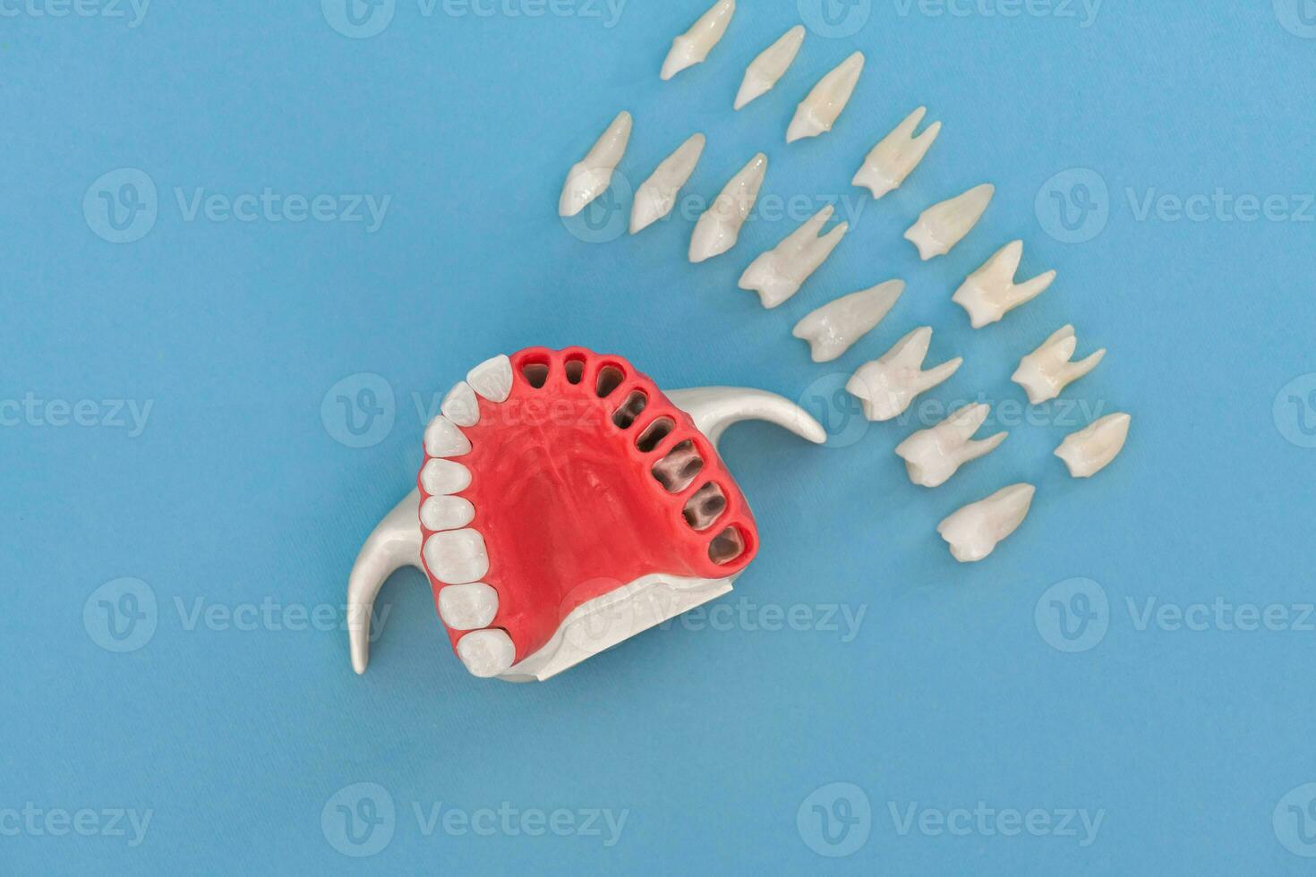tanden implantaat en kroon installatie werkwijze onderdelen geïsoleerd Aan een blauw achtergrond. medisch accuraat 3d model. foto