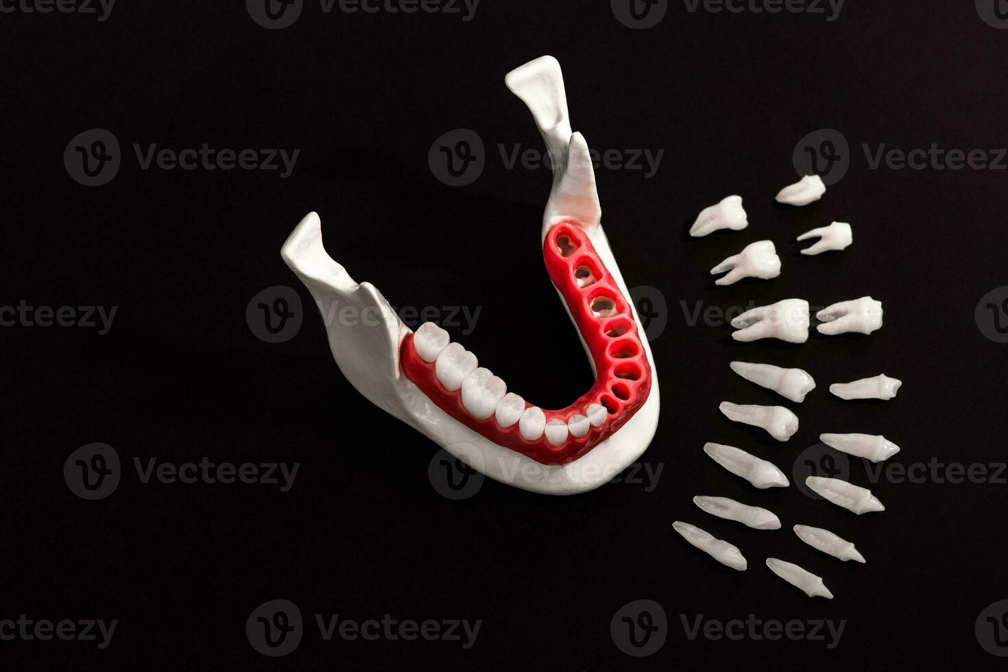 tanden implantaat en kroon installatie werkwijze onderdelen geïsoleerd Aan een zwart achtergrond. medisch accuraat 3d model. foto