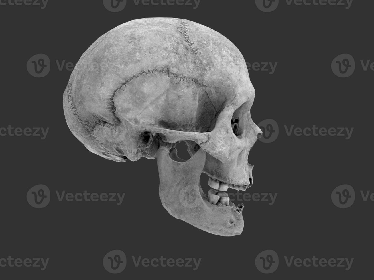 menselijk schedel met missend tanden - kant visie foto