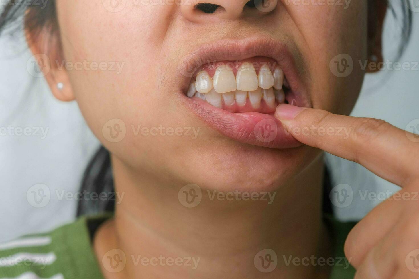 Aziatisch vrouw Holding haar hand- Aan haar wang gevoel kiespijn, tand verval, gingivitis of slecht adem probleem. kiespijn en mondeling Gezondheid concept. foto