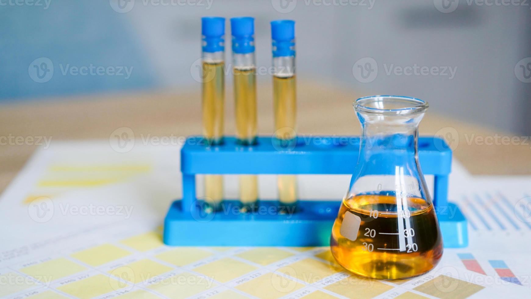 kolf en reageerbuisjes met urine op medische kleurenschema's foto