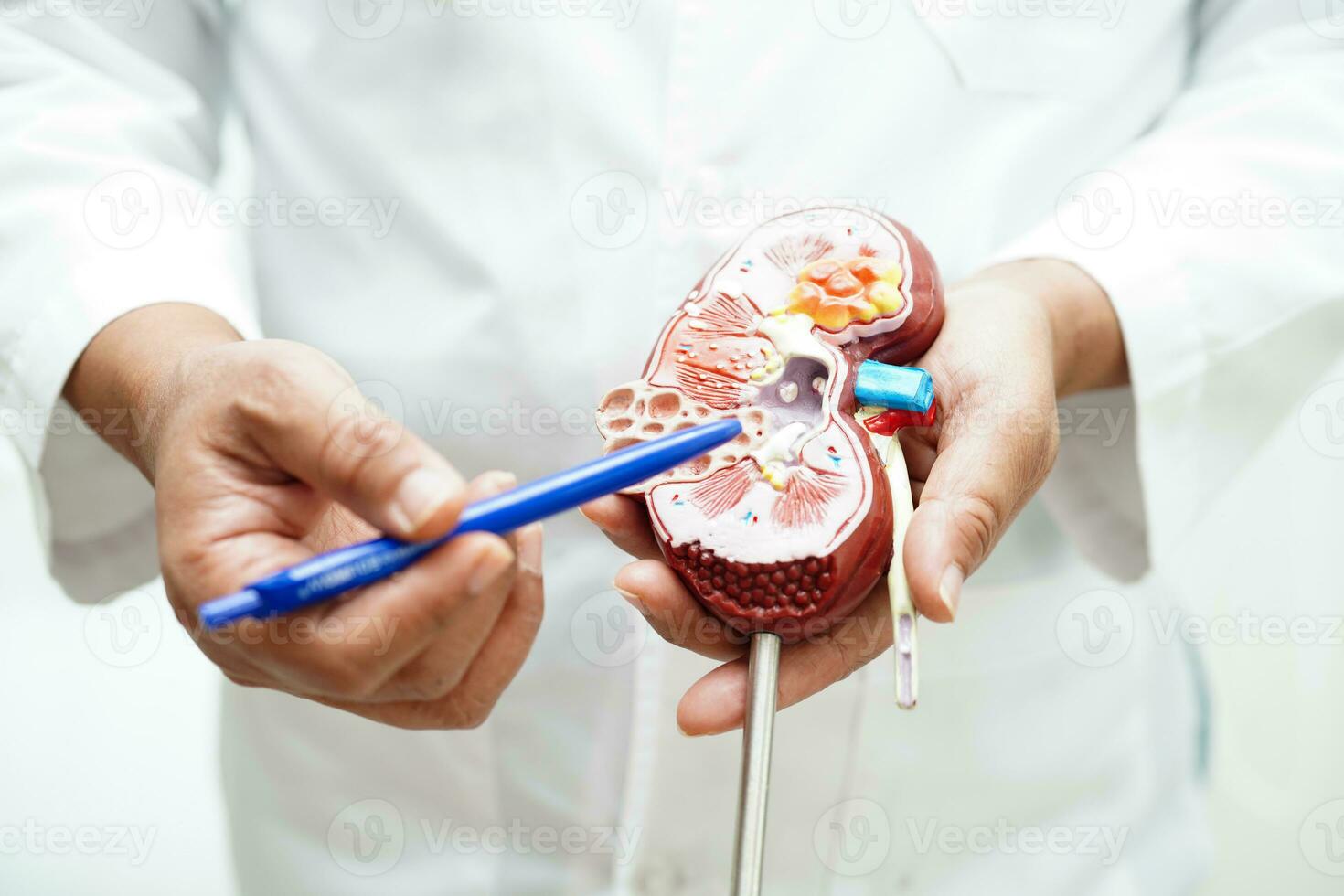 chronisch nier ziekte, dokter Holding model- voor behandeling urine- systeem, urologie, geschatte glomerulair filtratie tarief egr. foto