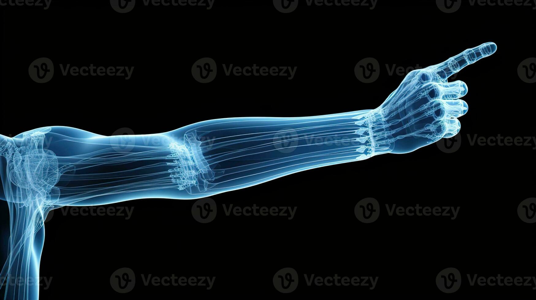orthopedische uitmuntendheid, gedetailleerd röntgenstraal van een mannetje menselijk arm in blauw tonen Aan een zwart achtergrond - ideaal voor nauwkeurig medisch in beeld brengen en diagnose, ai generatief foto