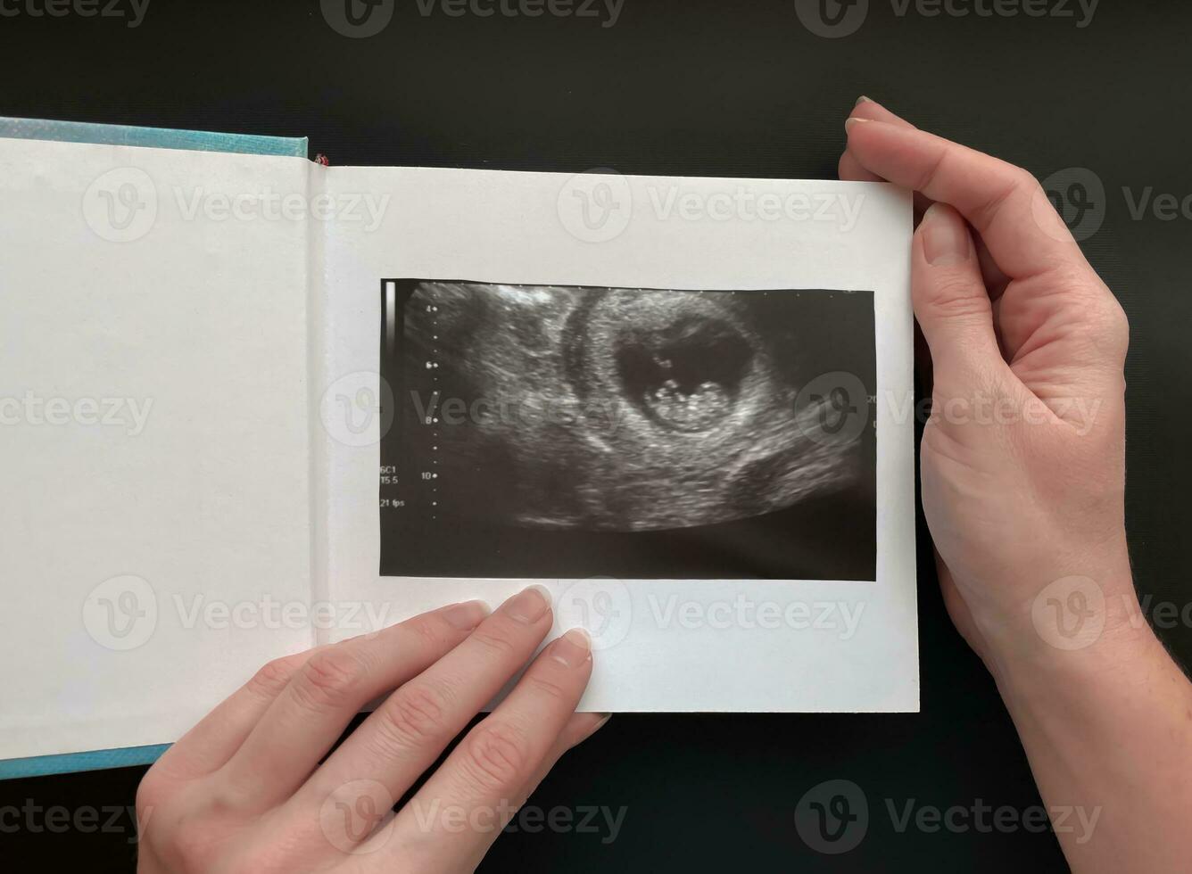 detailopname van vrouw handen Holding een notitieboekje in welke fotografie van een echografie scannen van de foetus foto