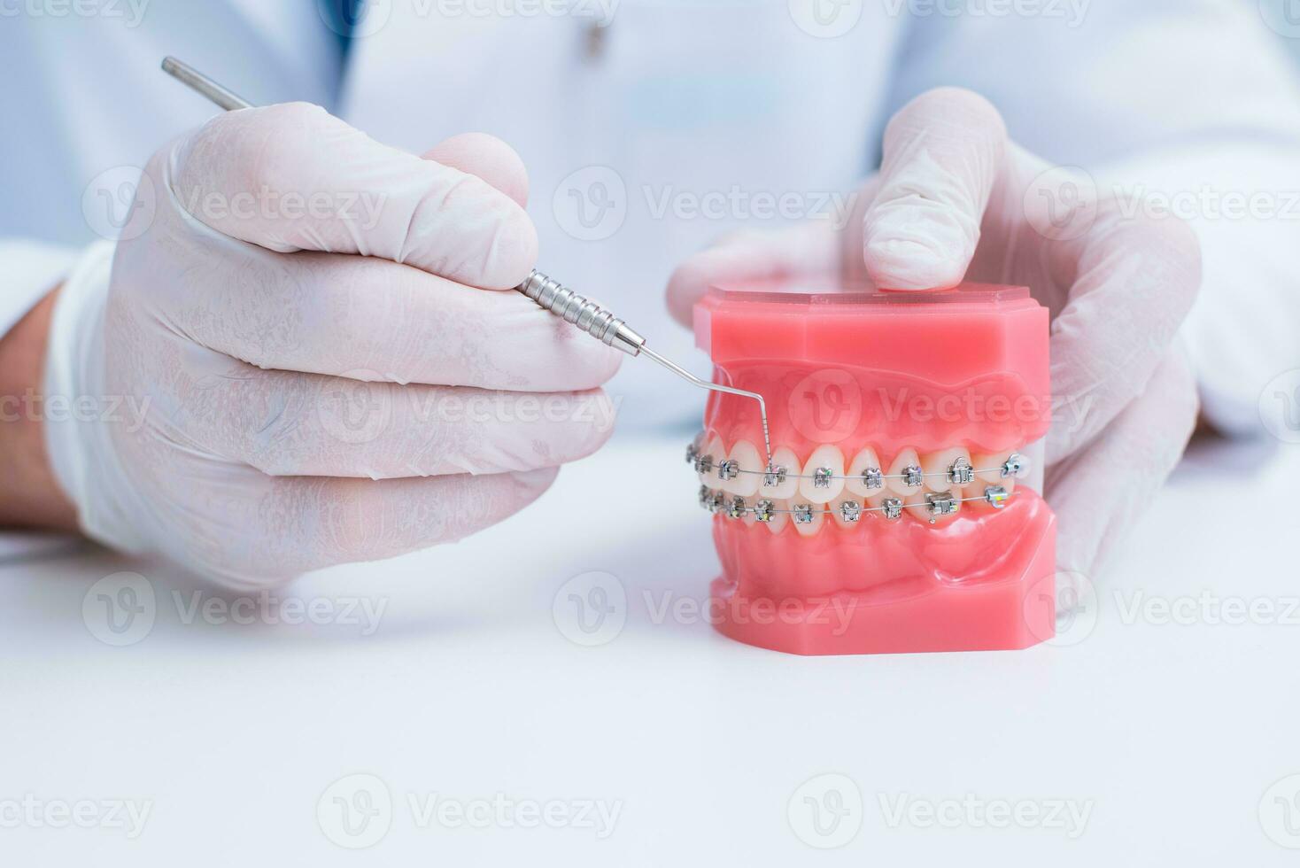 dokter orthodontist shows hoe de systeem van een beugel Aan tanden is geregeld foto