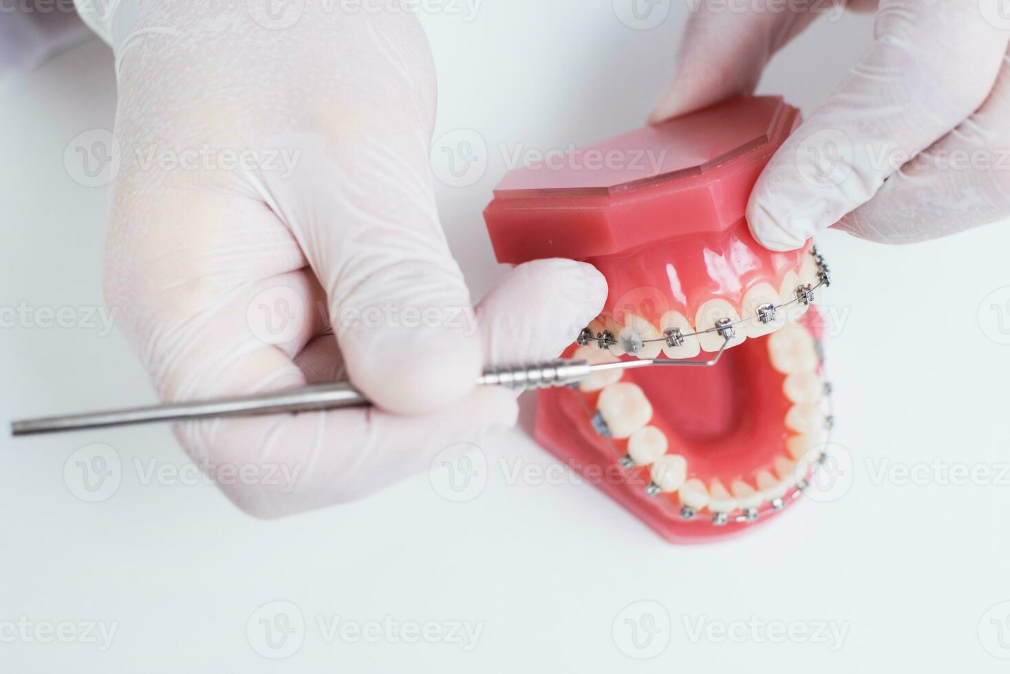 dokter orthodontist shows hoe de systeem van een beugel Aan tanden is geregeld foto