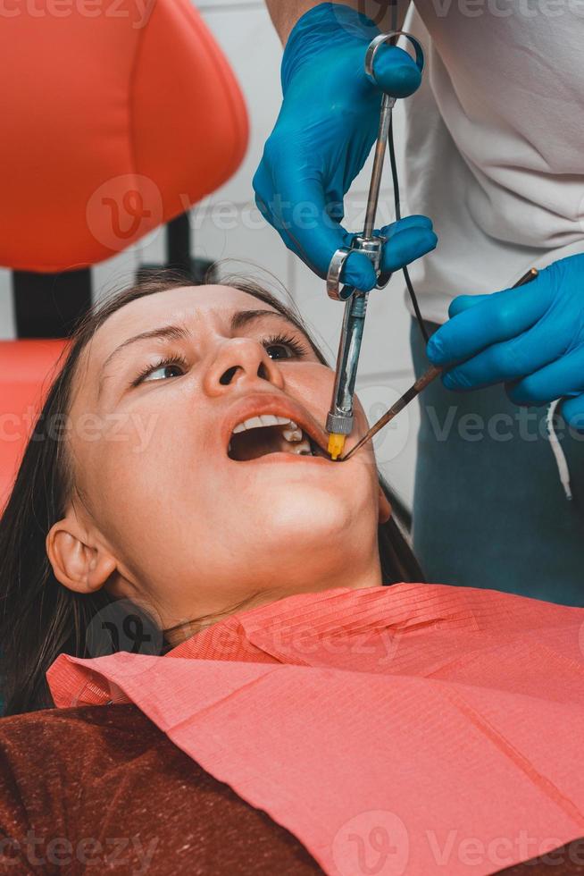 injectie met een carpule-spuit, de tandarts injecteert de patiënt. foto