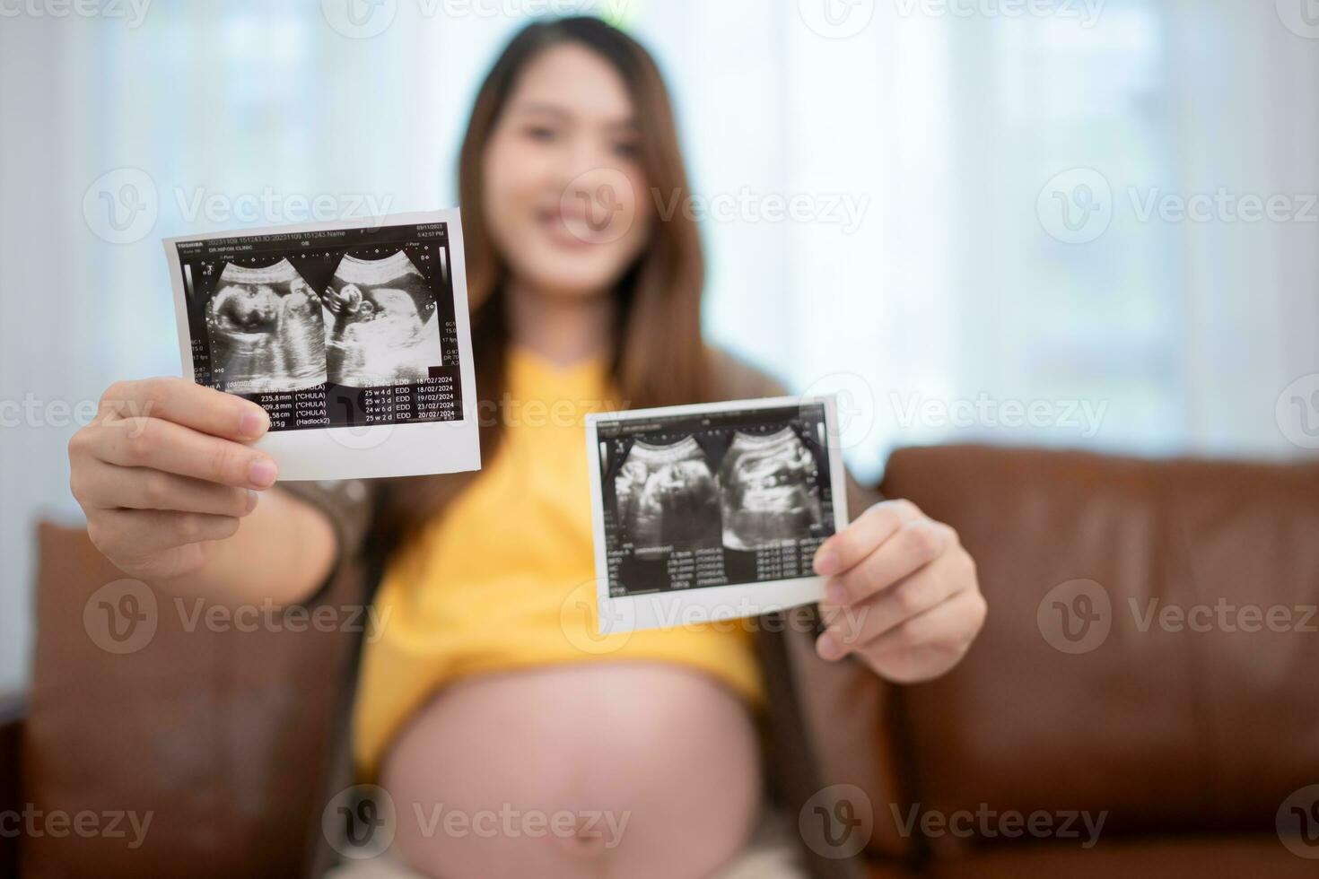 zwanger Aziatisch vrouw Holding echografie afbeelding van haar baby. foto