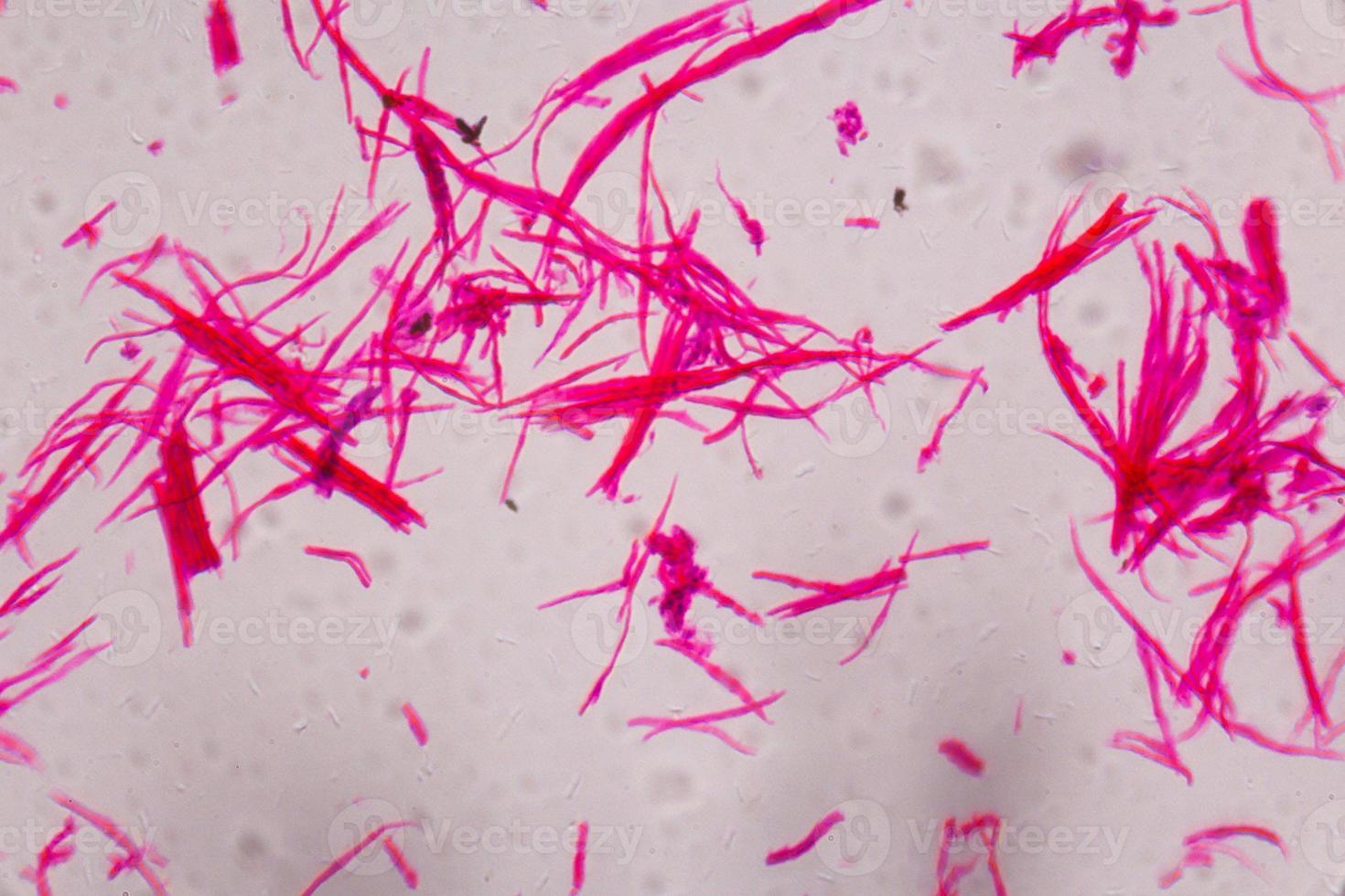 gladde spieren gescheiden onder de microscoop - abstracte roze lijnen op een witte achtergrond foto