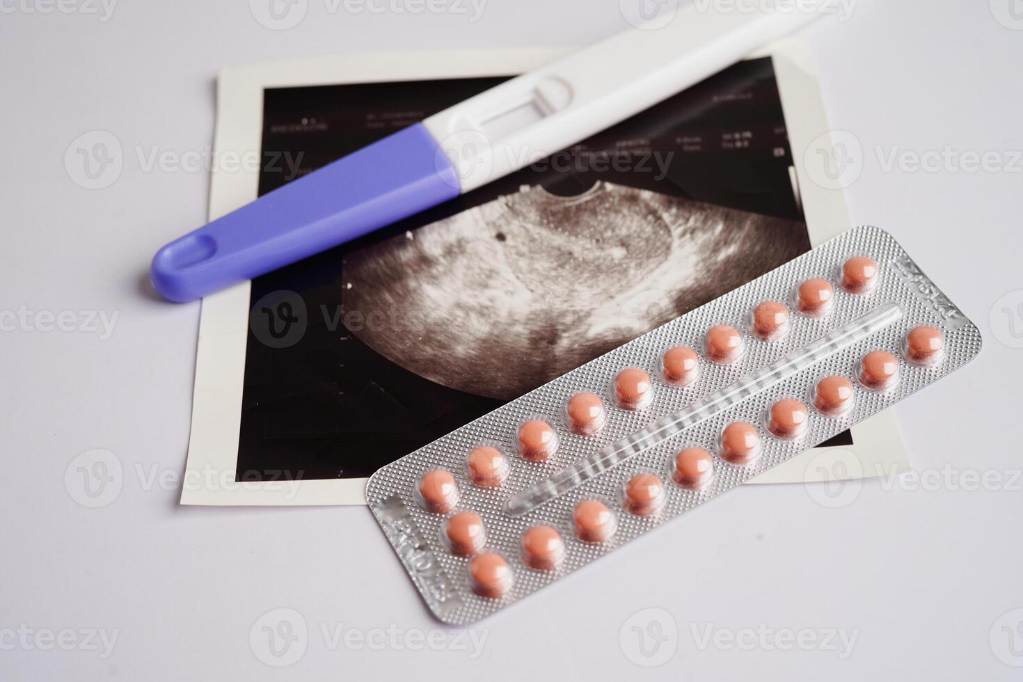 zwangerschap test met echografie scannen foto van foetus, moederschap, bevalling, geboorte controle.