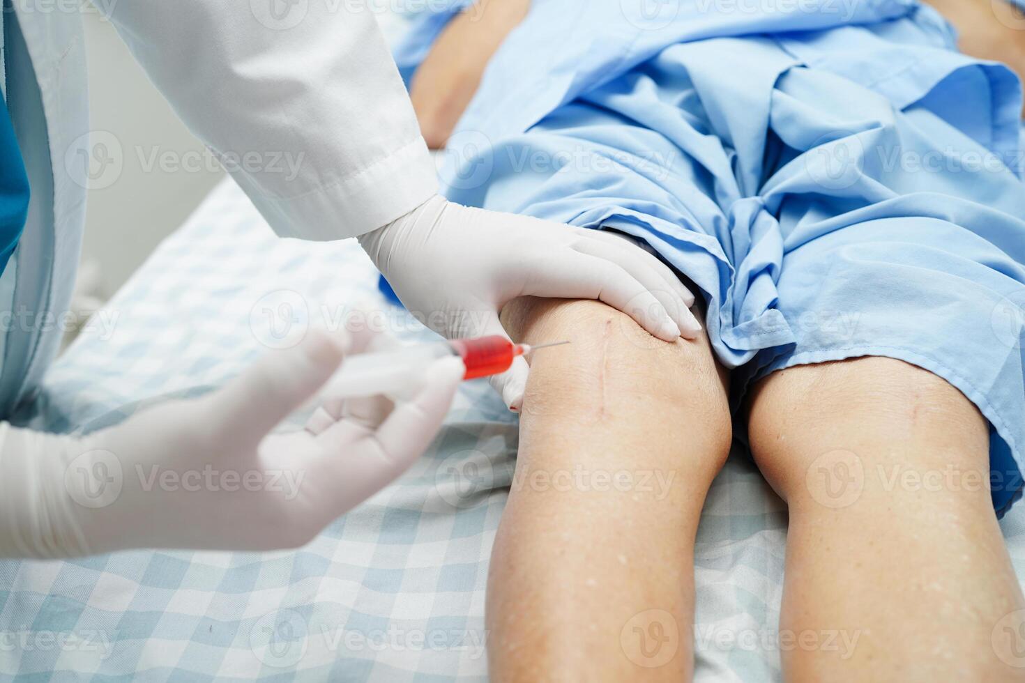 Aziatische arts injecteert hyaluronzuur bloedplaatjes rijk plasma in de knie van senior vrouw om te lopen zonder pijn. foto