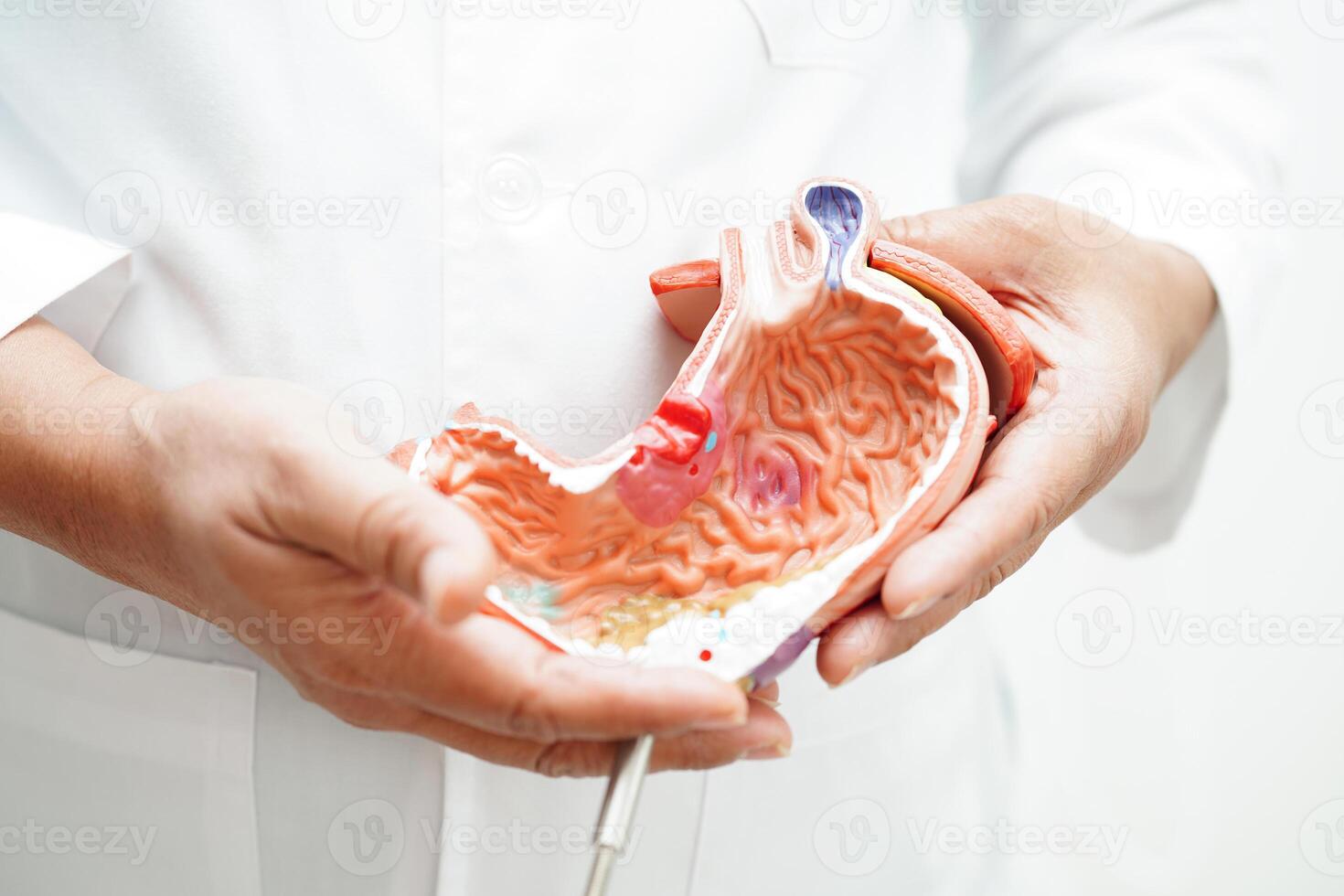 maag ziekte, dokter Holding anatomie model- voor studie diagnose en behandeling in ziekenhuis. foto