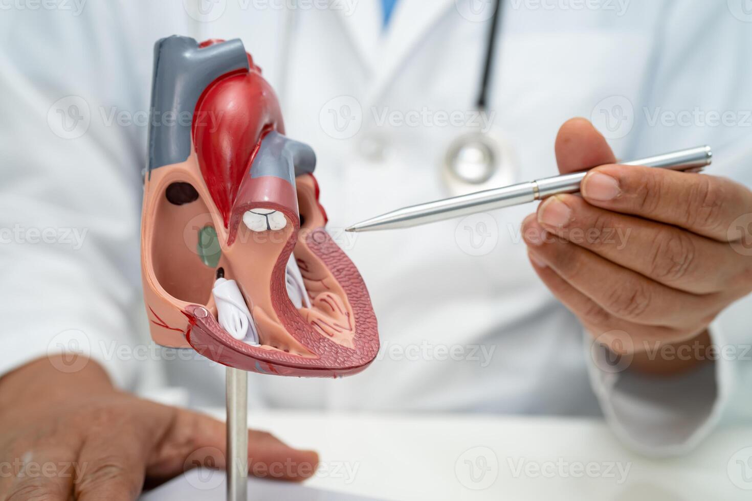 cardiovasculair ziekte cvd, Aziatisch dokter Holding menselijk anatomie model- voor leren en traktatie hart ziekte. foto