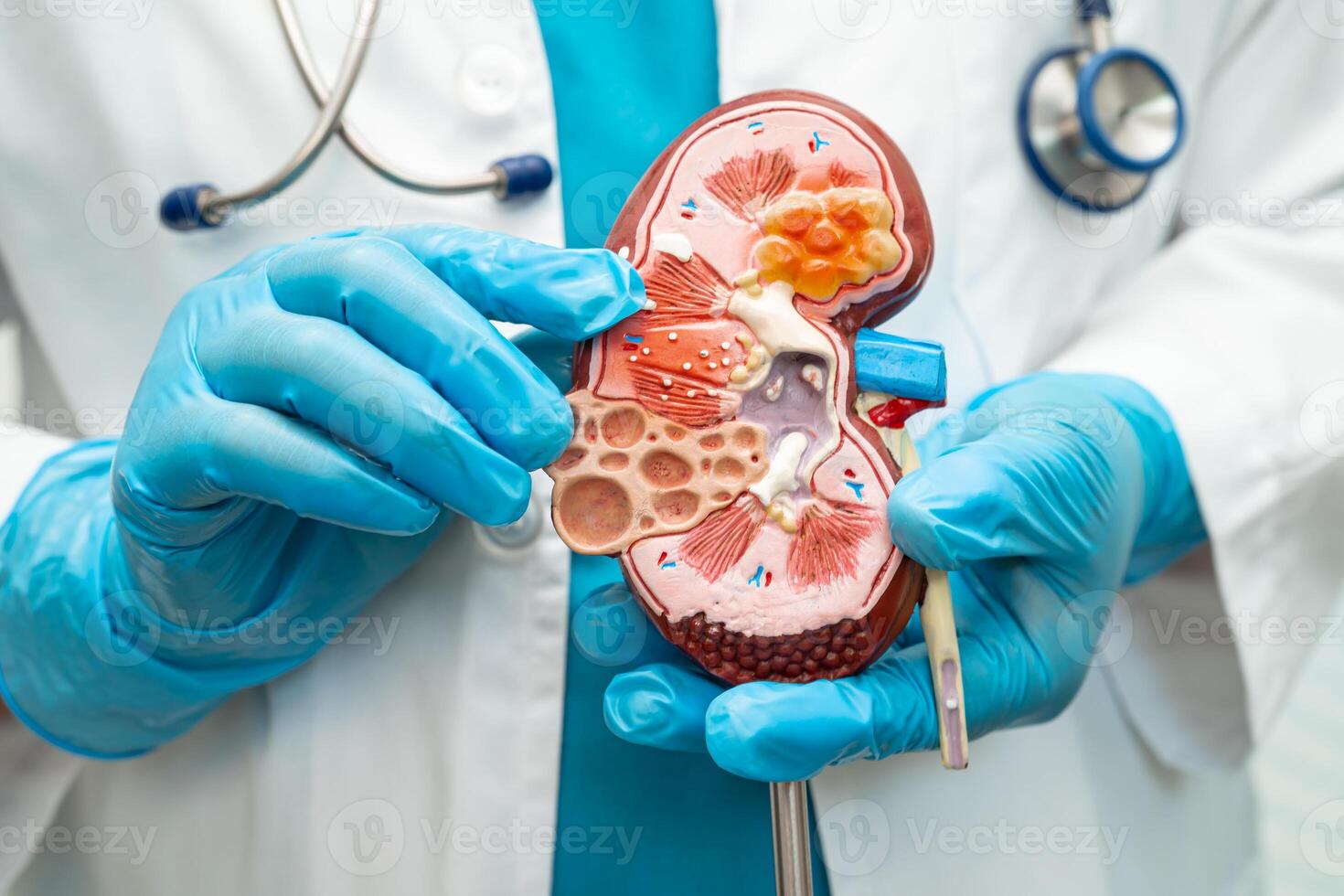 nier ziekte, chronisch nier ziekte ckd, dokter houden menselijk model- naar traktatie en studie in ziekenhuis. foto