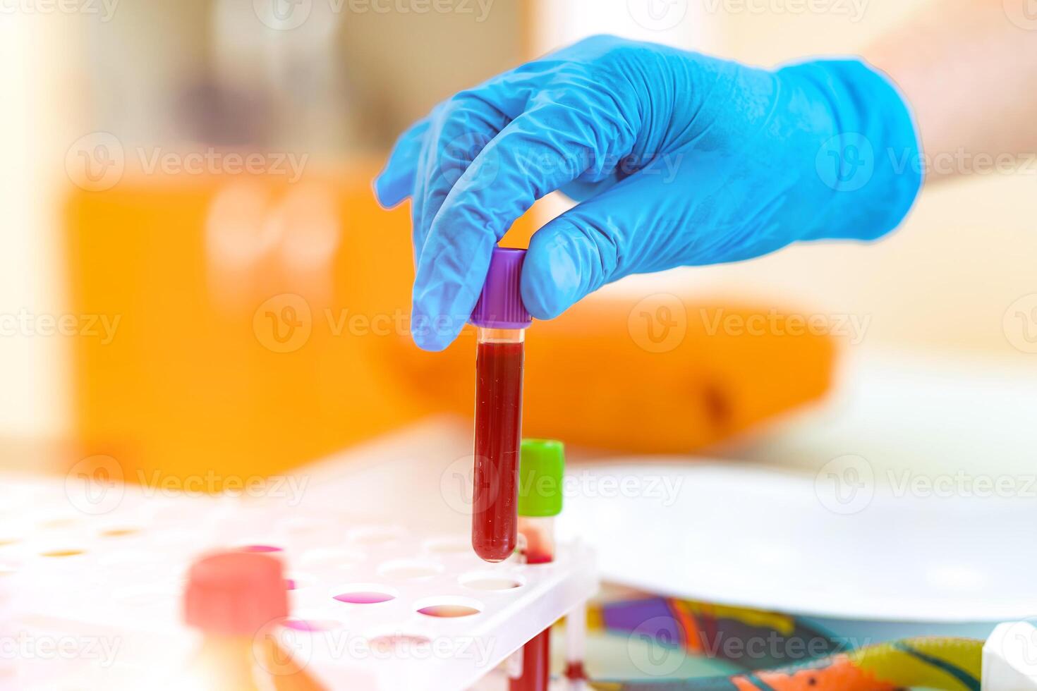 hand- in latex handschoenen van een laboratorium arbeider is zetten buis met bloed Aan een rek. blauw beschermend handschoen van een vrouw houdt een flacon met bloed Aan de achtergrond van speciaal dienblad Aan tafel. detailopname. foto